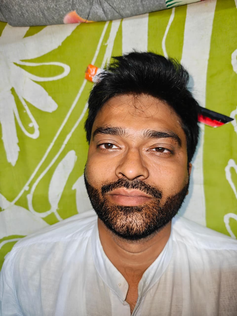 Acne Scar Treatment Results