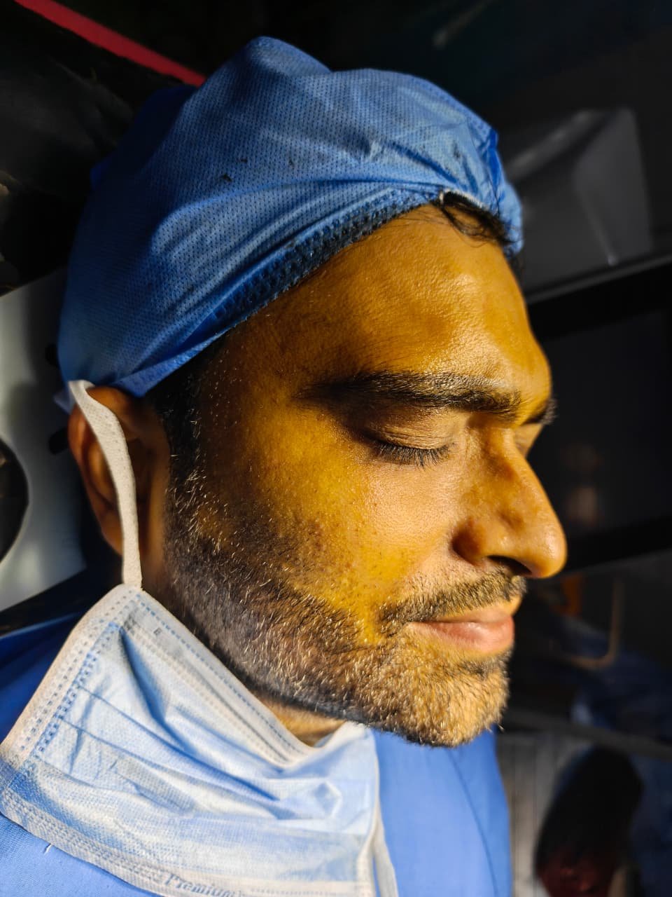 Under Eye Treatment Results