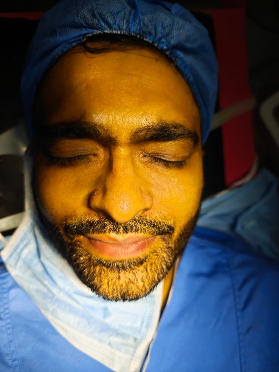 Acne Scar Treatment Results